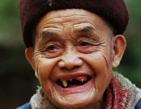 Why do old people lose their teeth