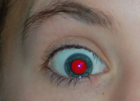 Why do people have red eyes in flash photograph