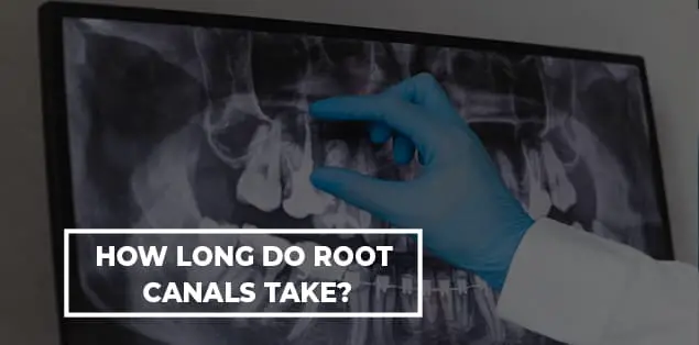 How Long Do Root Canals Take