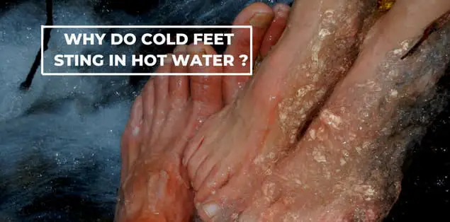 Why do cold feet sting in hot water