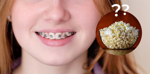 Can You Eat Popcorn With Braces?