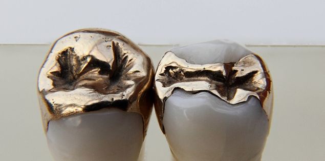 Why Do Pediatric Dentists Use Silver Crowns?